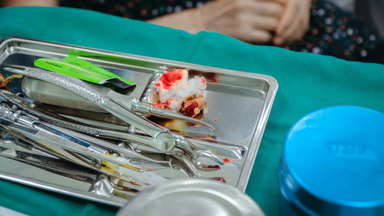 Với răng khôn – việc chủ động kiểm tra định kỳ, đánh giá kỹ càng và có kế hoạch theo dõi từ sớm mới là giải pháp an toàn nhất.