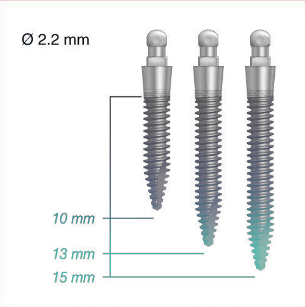 Nhược điểm của mini implant