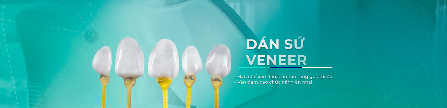 Dán sứ thẩm mỹ Veneer