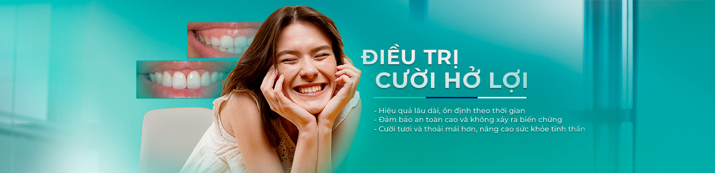 Điều trị cười hở lợi