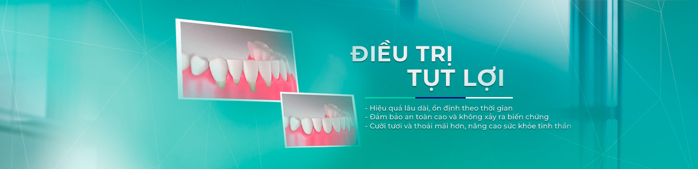 Điều trị tụt lợi