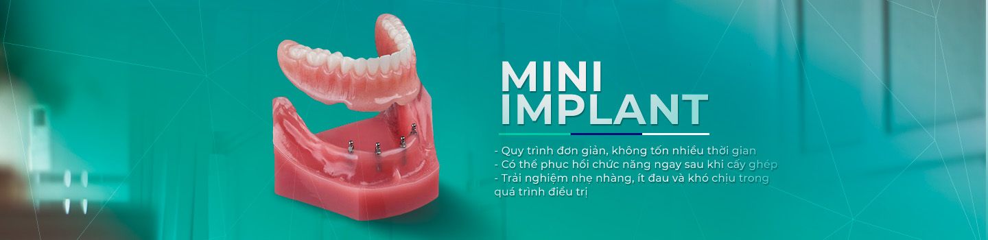 Mini Implant