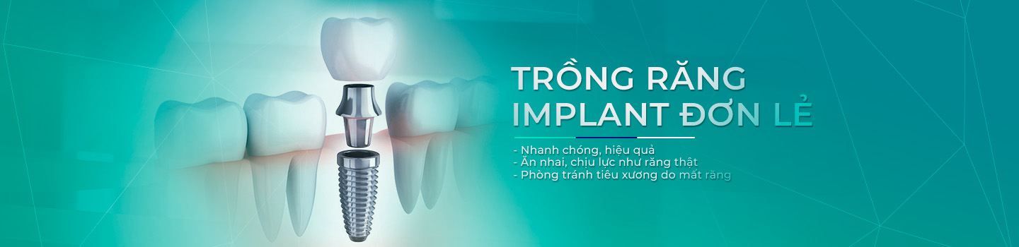 Trồng răng đơn lẻ