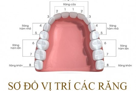 Răng số 8 là răng gì? Có nên nhổ răng số 8 không?
