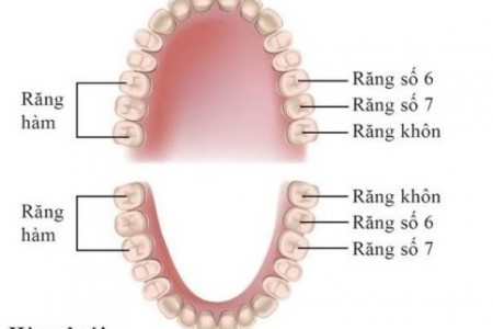 Răng số 8 là răng gì? Khi nào nên nhổ răng số 8