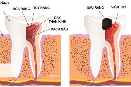 Tủy răng có tác dụng gì?