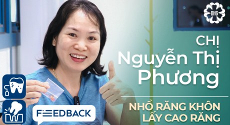 chi-phuong-cao-rang-va-nho-rang-khon
