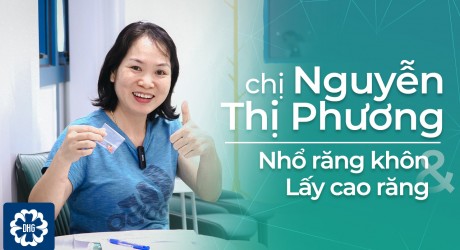 chi-phuong-nho-rang-khon-va-lay-cao-rang