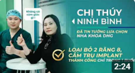 Chị Thúy nhổ 2 răng 8 và cắm trụ Implant trong ngày vẫn thoải mái chia sẻ cảm nhận