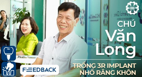 chu-dinh-van-long-implant-va-nho-rang