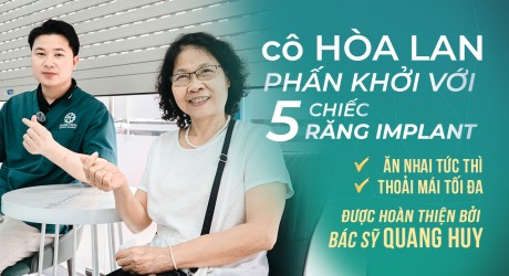 co-hoa-lan-trong-5-rang-implant