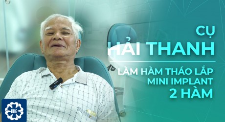 cu-hai-thanh-mini-implant-ham-thao-lap