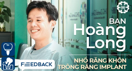 hoang-long-trong-rang-implant-va-nho-rang-khon